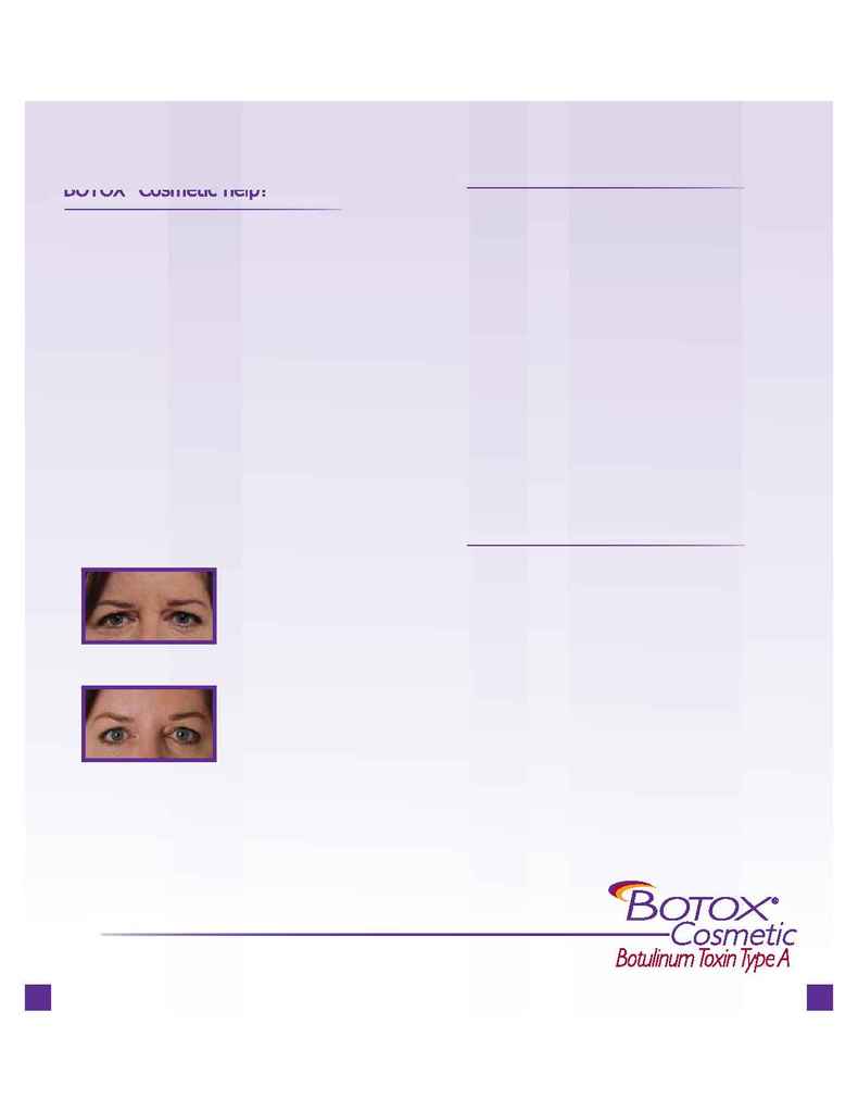 Body By Fisher - BOTOX Cosmetic brochure