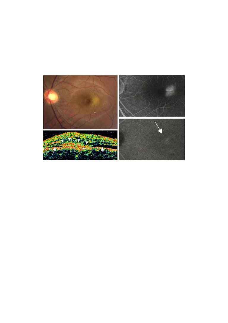 American Journal of Ophthalmology - AJO 2917