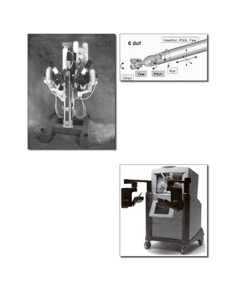 Mitral Valve Surgery - JLT 1306(206)